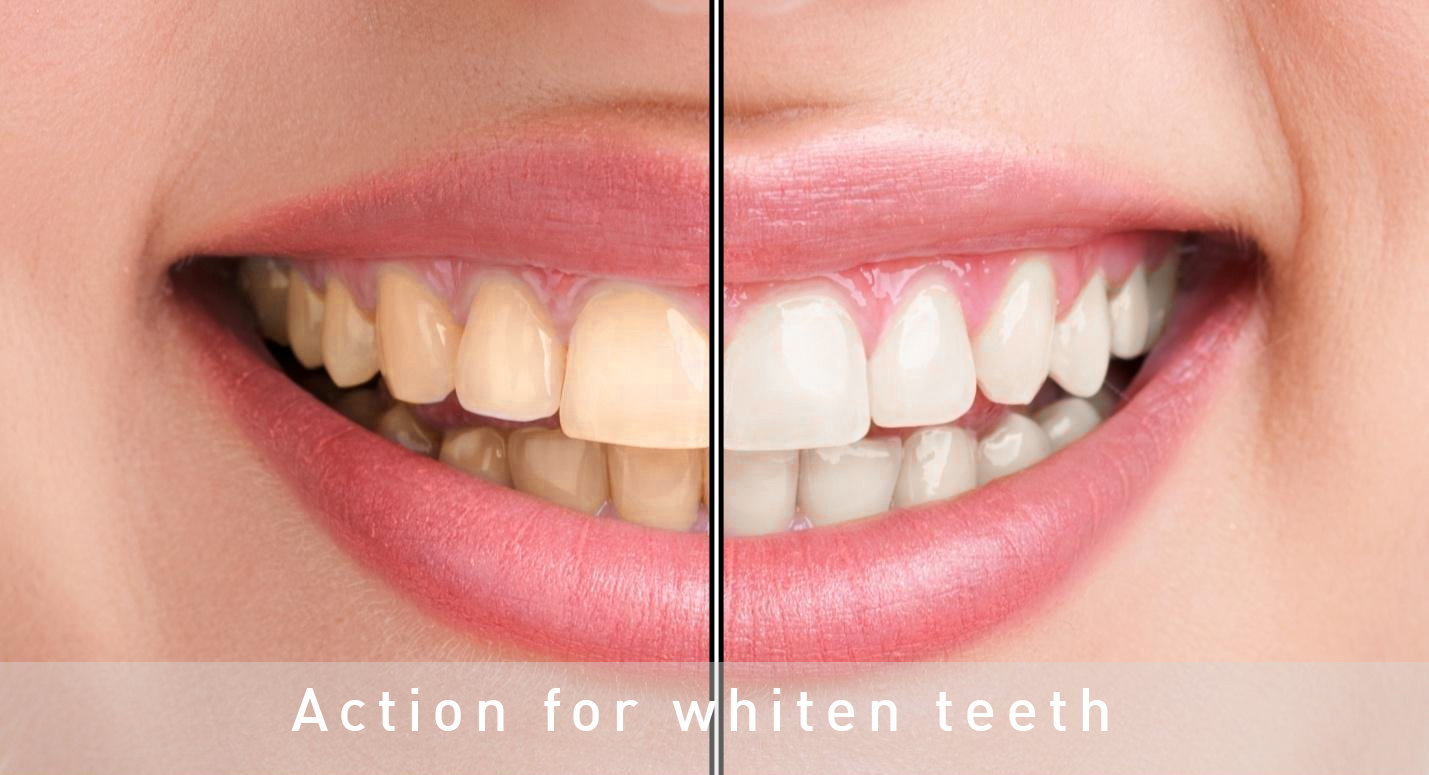 Action for whiten teeth in Photoshop