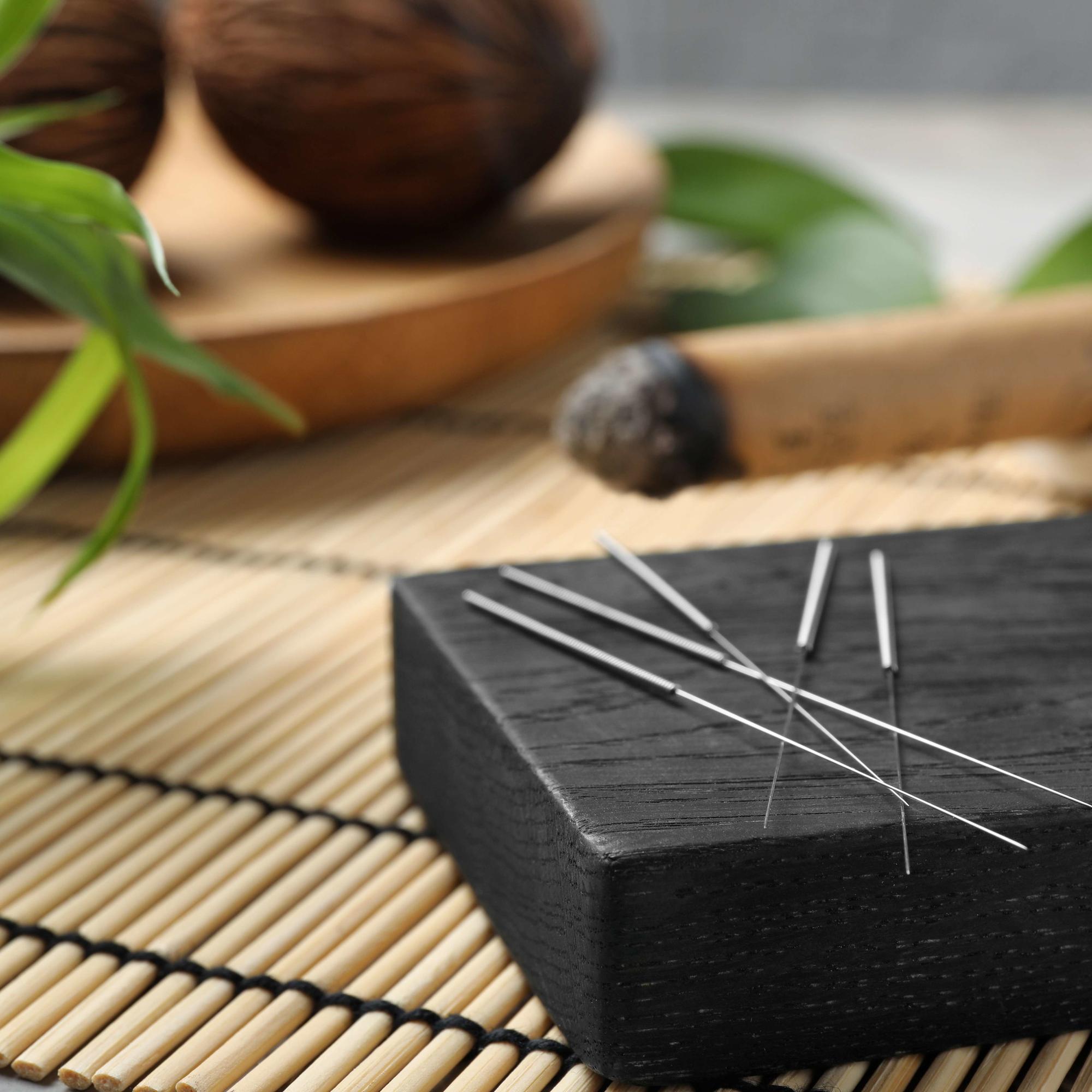 Корпоральное иглоукалывание