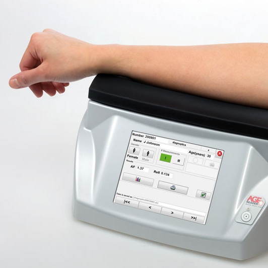 Тестирование гликации AGE Reader